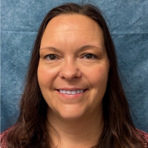 Shi Severson's profile photo